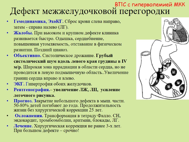 Дефект межжелудочковой перегородки ВПС с гиперволемией МКК Гемодинамика, ЭхоКГ. Сброс крови слева направо, затем